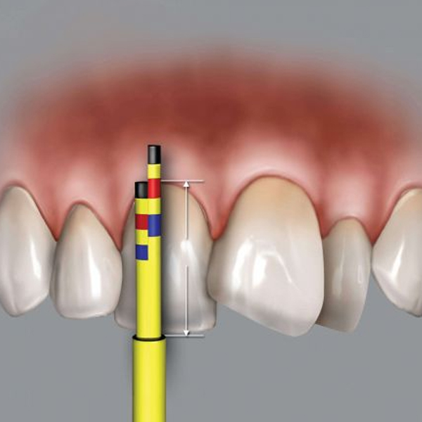 SONDA DR.CHU - REGLA DE PROPORCION,PROGS - HU-FRIEDY