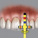 SONDA DR.CHU - REGLA DE PROPORCION,PROGS - HU-FRIEDY